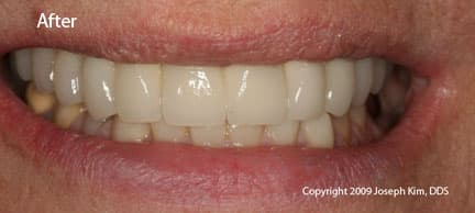 Dental Fiasco · Close view — after