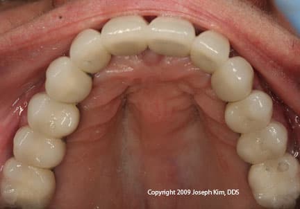 Dental Fiasco · Occlusal — after