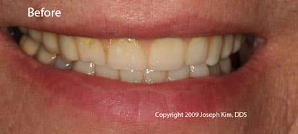 Dental Fiasco · Close view — before