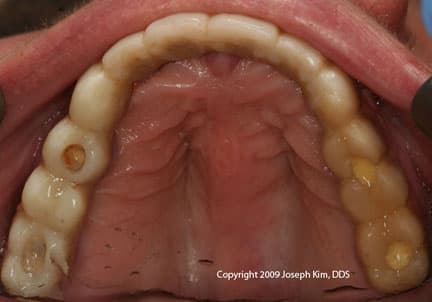 Dental Fiasco · Occlusal — before